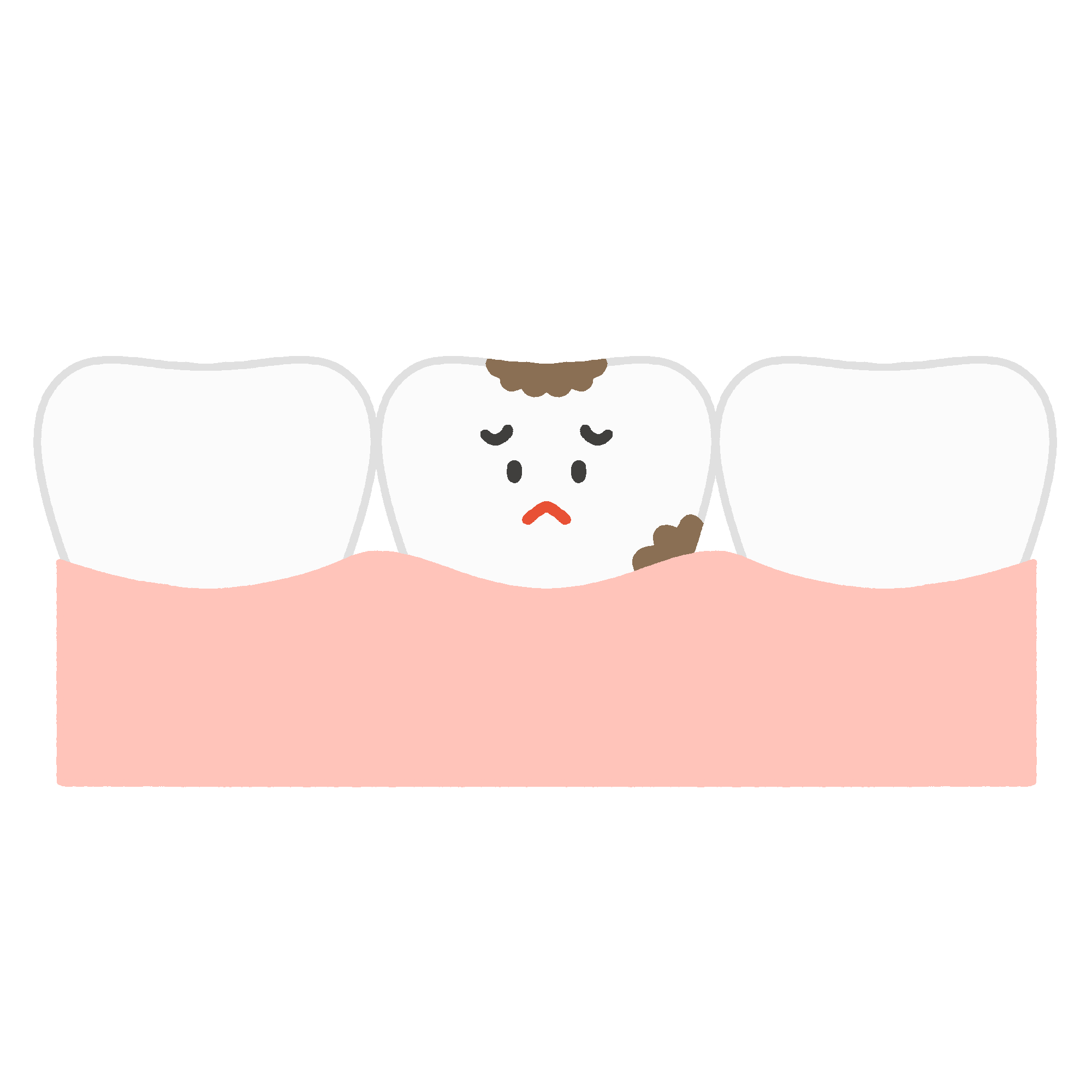 歯ぐき・虫歯の無料イラスト素材