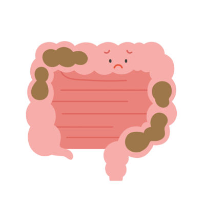 うんちが溜まった腸のキャラクターの無料イラスト｜保健向け素材